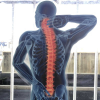 Human Spine X-ray